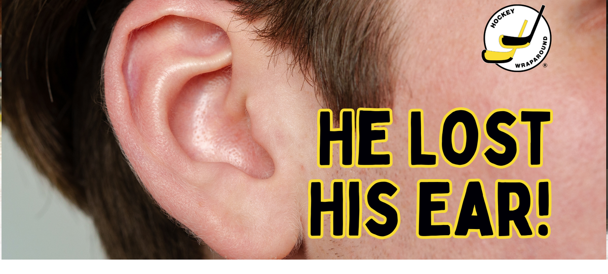 He Lost His Ear!
